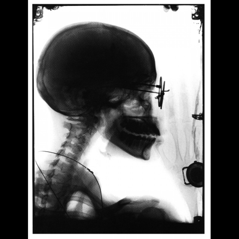 X-ray-profile