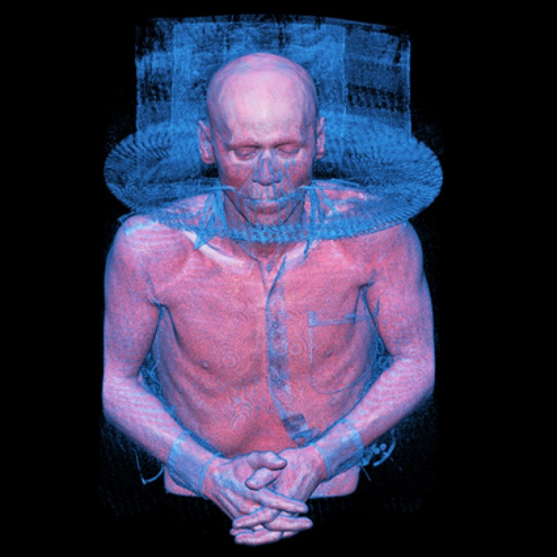 X-ray-robert