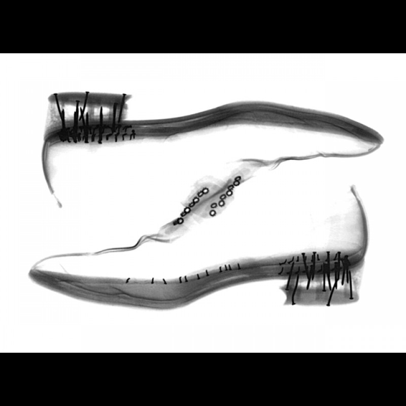 X-ray-shoes